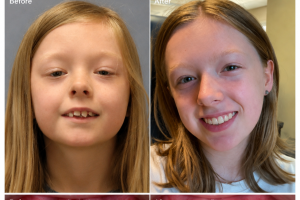 A Beautiful Smile Starts with a Healthy Smile