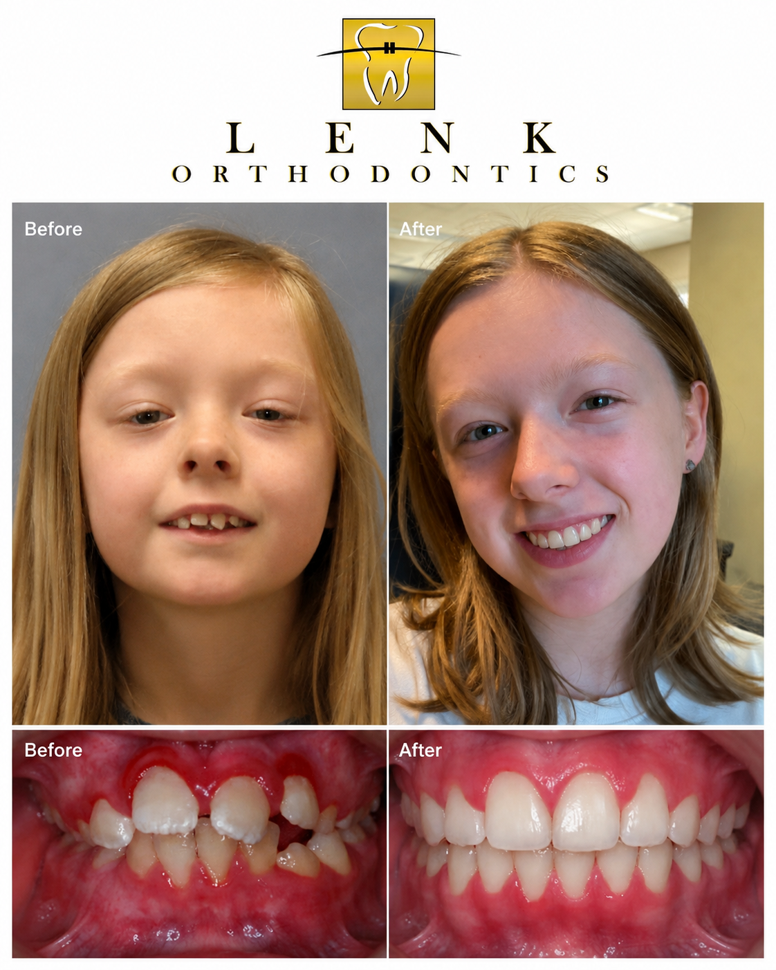 A Beautiful Smile Starts with a Healthy Smile