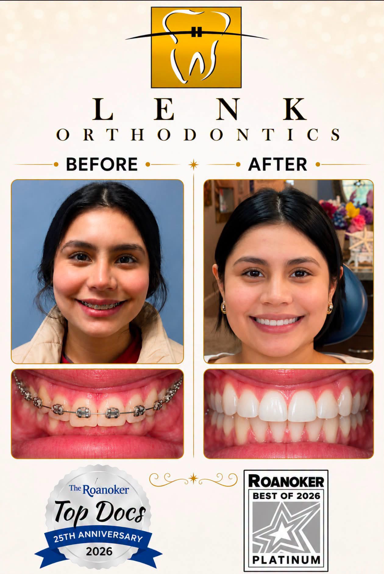 She transferred to our office wondering if continuing orthodontic treatment was really worth it…